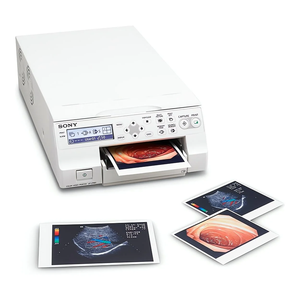Sony Pro UP-27MD Medical Colour Video Printer - Image 6